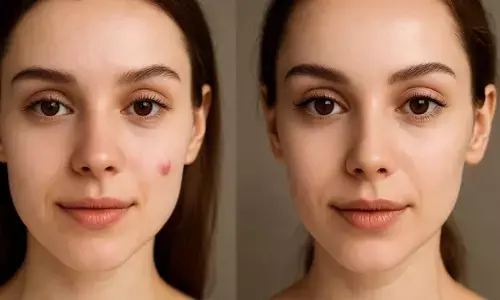 चेहरे को साफ कैसे रखें चेहरे को साफ कैसे रखें