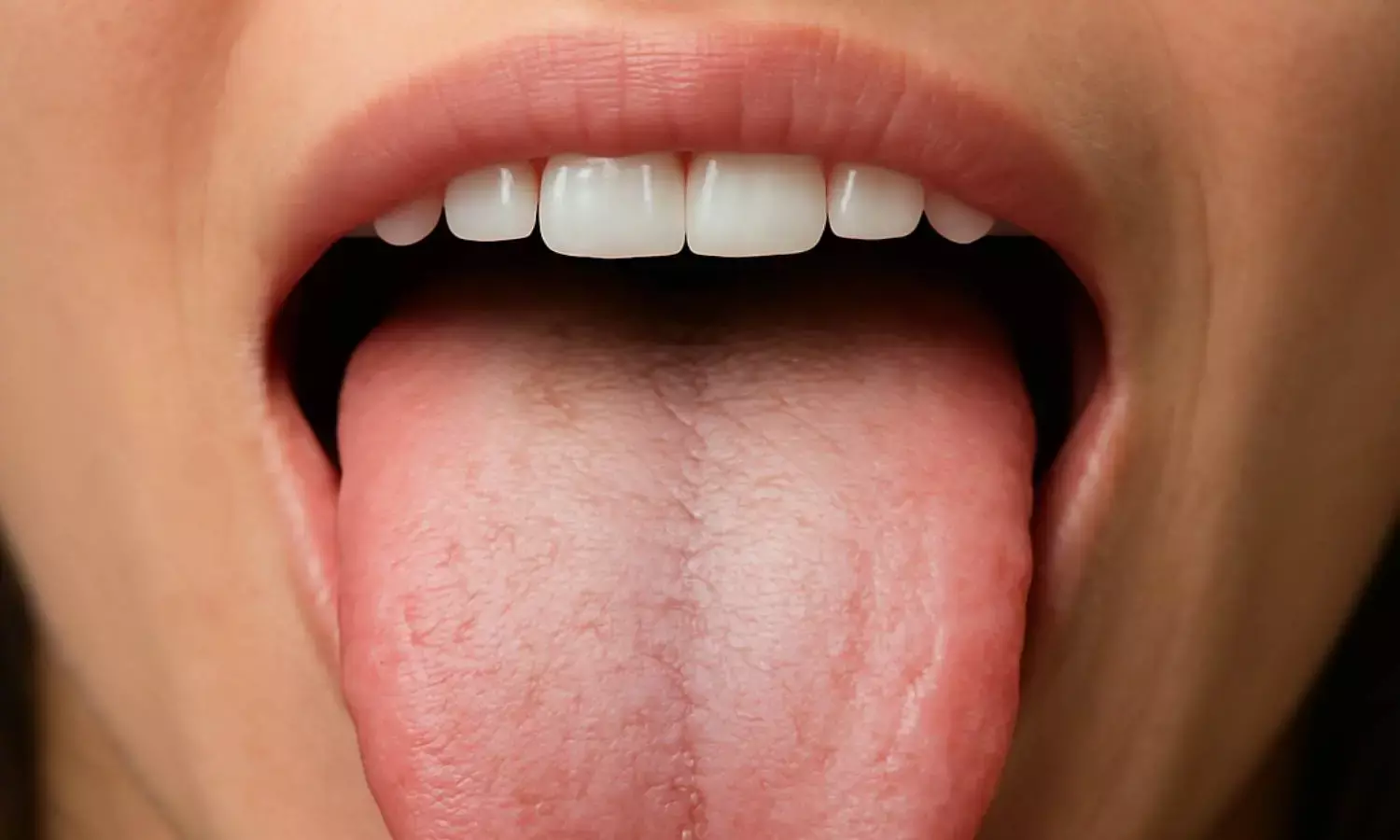 Tongue color and health problems