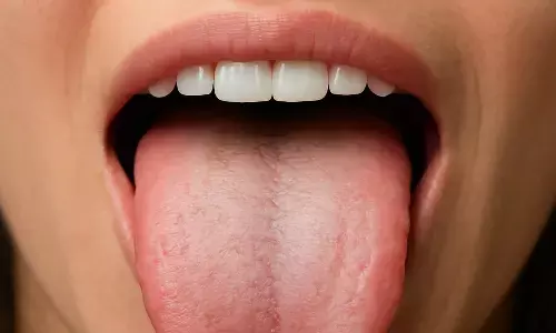 Tongue color and health problems
