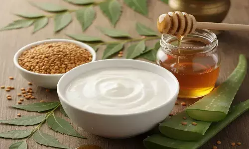 dandruff home remedies