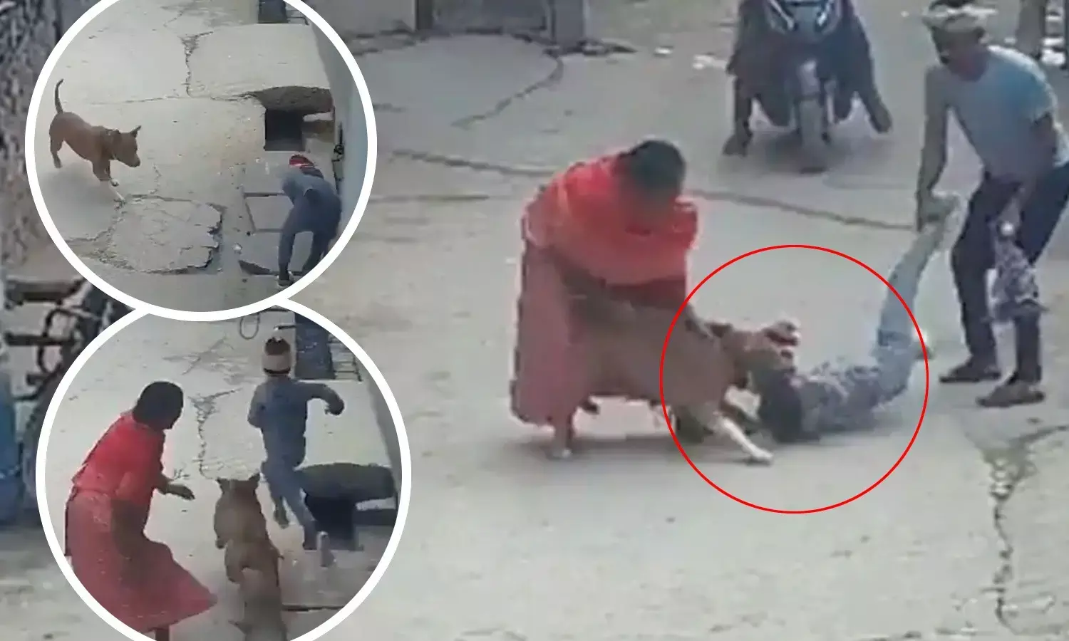 Delhi Pitbull Attack Video