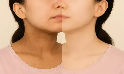 black neck home remedies