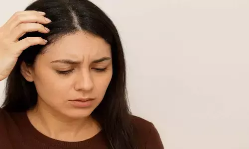 best natural treatments for dandruff control