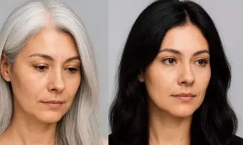 सफेद बालों को काला कैसे करें सफेद बालों को काला कैसे करें