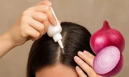 onion juice hair care tips