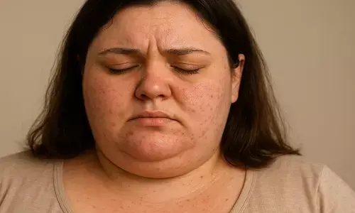 PCOS वाली महिलाओं के लिए हेल्दी टिप्स PCOS वाली महिलाओं के लिए हेल्दी टिप्स