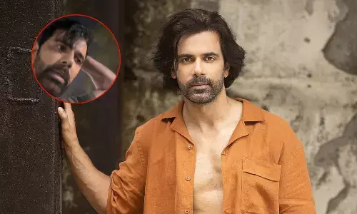 टीवी एक्टर अनुज सचदेवा पर हमला, सोसाइटी में रहने वाले शख्स ने डंडे से मारा, जान से मारने की धमकी दी