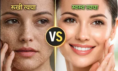 सर्दियों में स्किन केयर टिप्स