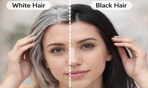 सफेद बालों को काला करने के उपाय