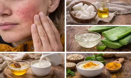 winter dry skin caring tips in hindi