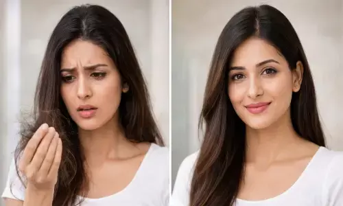 झड़ते बालों को बचाने के लिए घरेलू उपाय