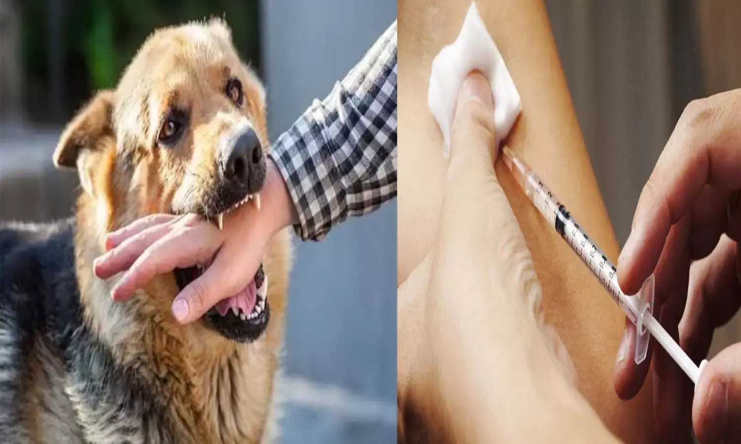 छत्तीसगढ़ में कुत्तों का खौफ : 12 महीने में ही सरकारी अस्पतालों में खपे एंटी रेबीज के पौने दो लाख डोज