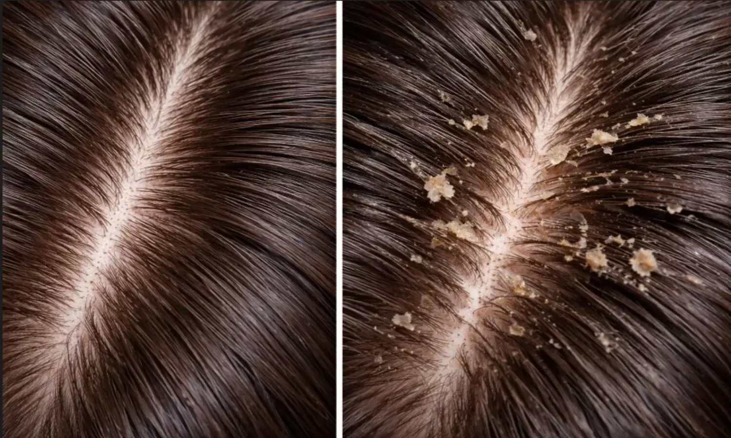 बालों की देखभाल