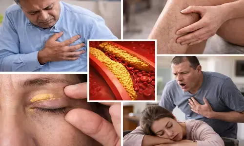 early signs of high cholesterol