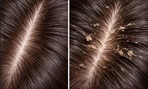 बालों की देखभाल