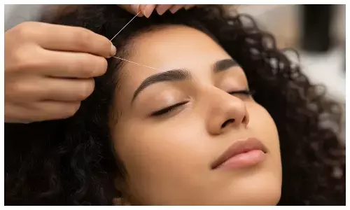 How to reduce redness after threading