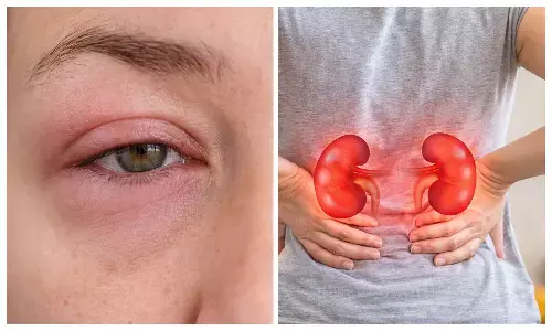 symptoms of kidney diseases