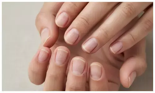 what nails say about your health